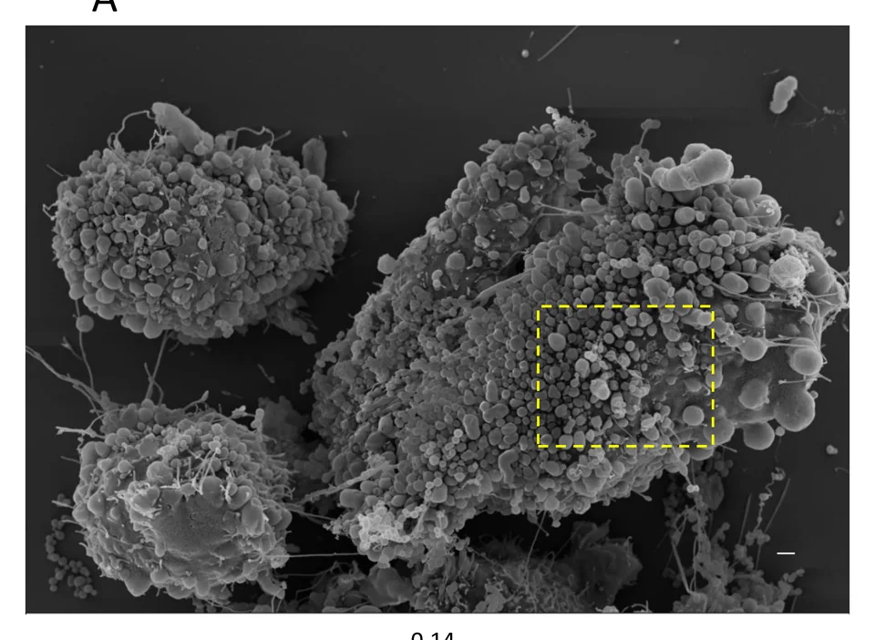 Figure from “Modeling the excess cell surface stored in a complex morphology of bleb-like protrusions”